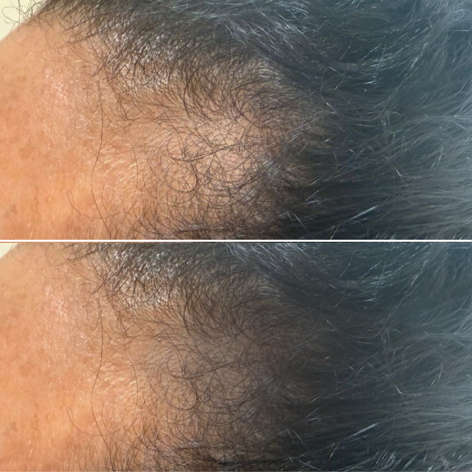 Perfil bonito é equilíbrio. (7)